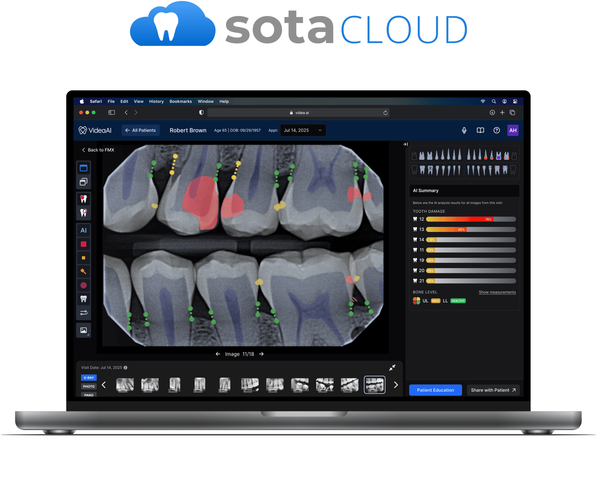 VideaHealth Sota Cloud