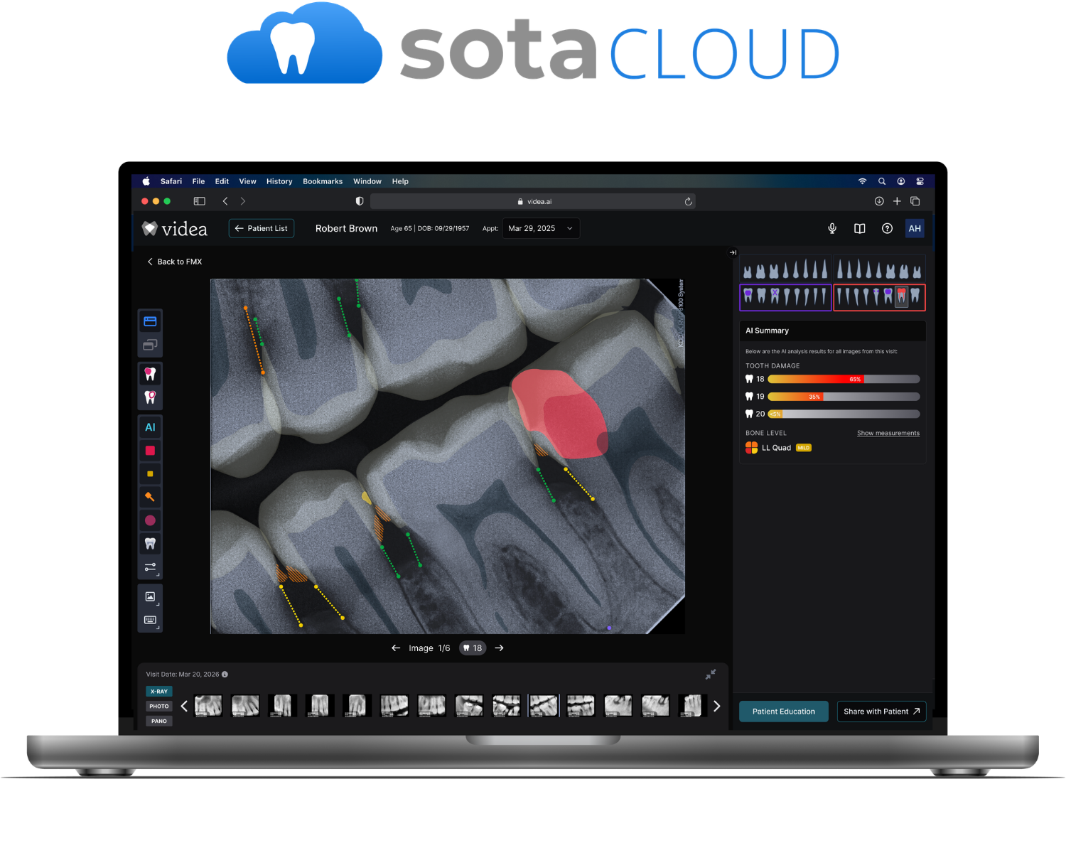 VideaHealth Integration  (1)