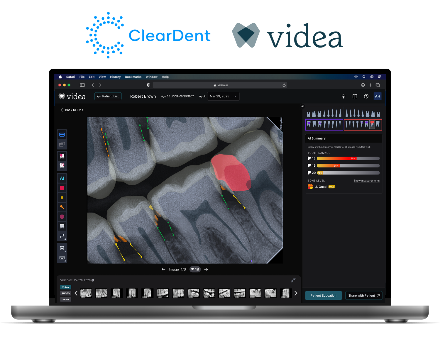 VideaHealth Integration  (4)